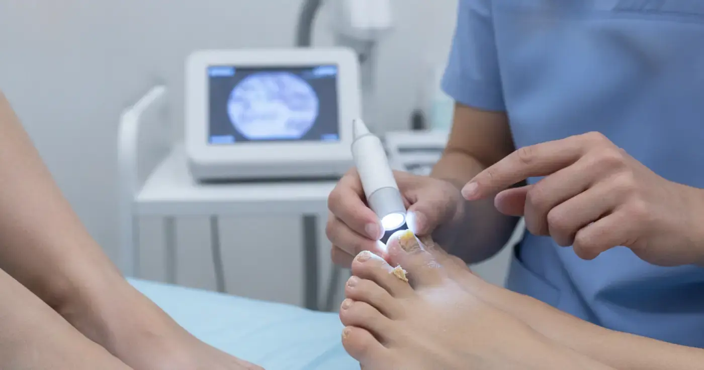Nail Fungus: Causes, Symptoms, and Treatment Options