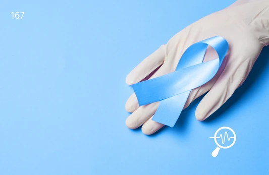 Androstenedione Hormone Balance Test