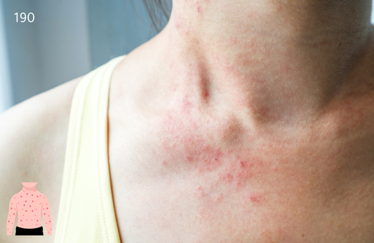 Vascular Inflammation Test