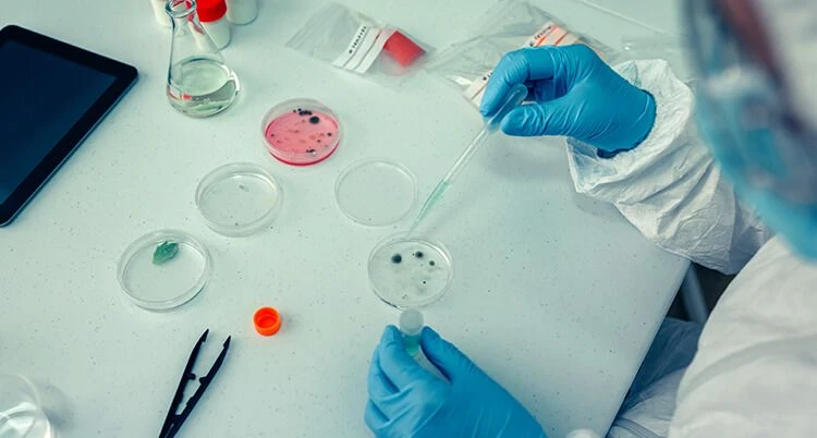 Body Fluid Culture Test
