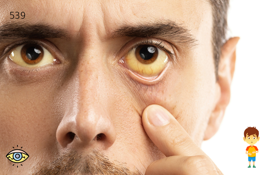 Monitor Your Doxycycline Therapy