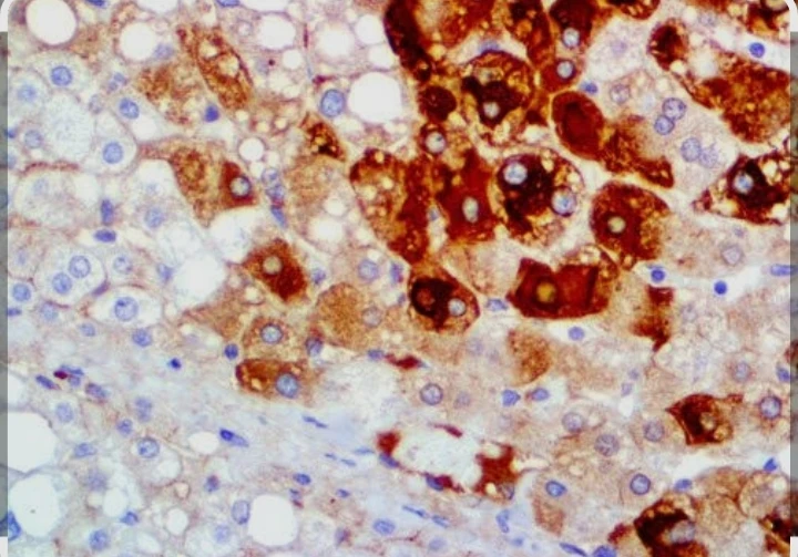Hepatitis B Immunity Test