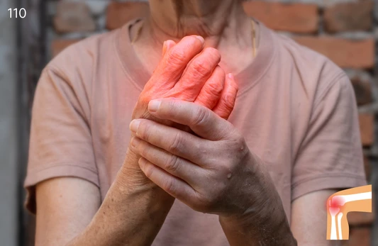 Uric Acid Test for Gout Prevention