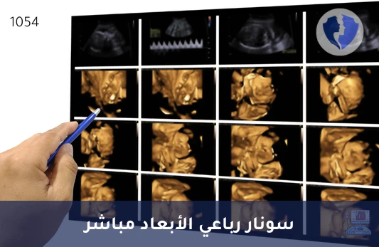 أشعة سونار رباعية الأبعاد (4D Ultrasound) - أشعة سونار رباعية الأبعاد