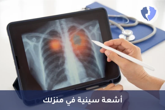 أشعة سينية منزلية (X-Ray) - أشعة سينية في منزلك