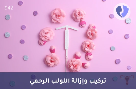 إجراء تركيب أو إزالة اللولب الرحمي (IUD) مع الكشف - تركيب أو إزالة اللولب