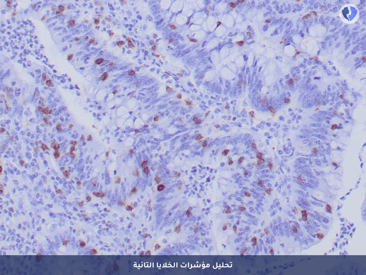باقة تحليل الكيمياء النسيجية المناعية (CD103) - باقة تشخيص أمراض الأمعاء المناعية