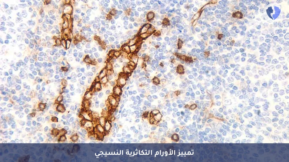 باقة تحليل الكيمياء النسيجية المناعية (CD123) - باقة تشخيص أورام الدم واللمف