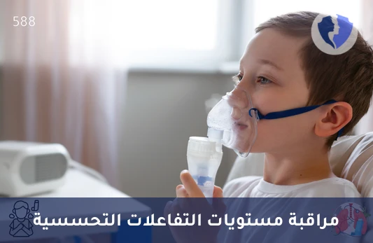 تحليل إن-ميثيل هستامين في بول 24 ساعة (N-Methylhistamine) - تحليل الهيستامين عبر البول