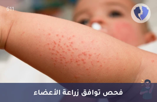 تحليل الأجسام المضادة التفاعلية (PRA) - فحص الجاهزية المناعية للزراعة