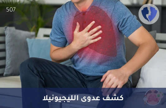 تحليل الأجسام المضادة لبكتيريا ليجيونيلا (Legionella pneumophila IgA) - فحص أجسام ليجيونيلا المضادة (IgA)