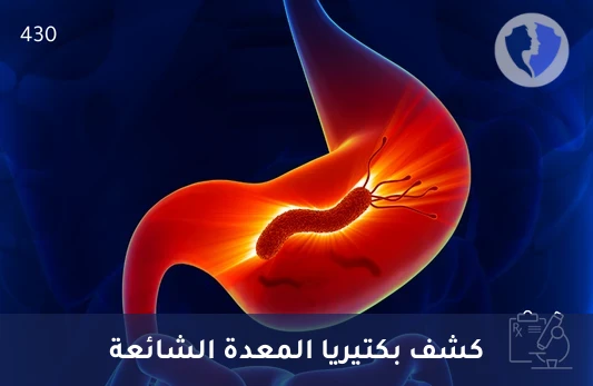 تحليل الأجسام المضادة لجرثومة المعدة (H. pylori IgG) - فحص أجسام جرثومة المعدة IgG