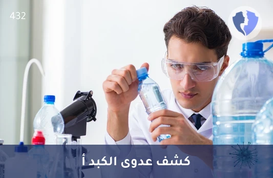 تحليل الأجسام المضادة لفيروس التهاب الكبد أ (HAV IgM) - فحص التهاب الكبد (أ) الحاد