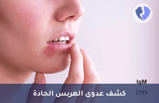 تحليل الأجسام المضادة لفيروس الهربس البسيط النوع 1 (HSV-1 IgM) - فحص فيروس الهربس الفموي (IgM)
