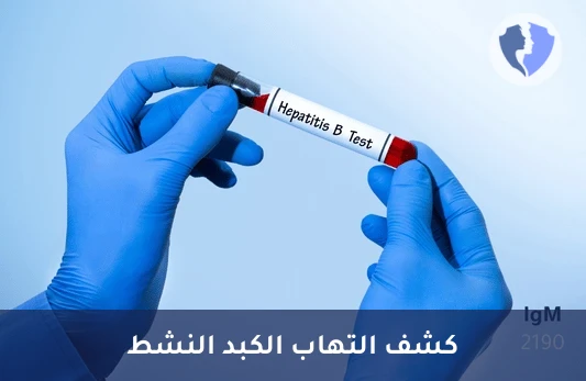 تحليل الأجسام المضادة للب الكبد الوبائي ب (HBc IgM) - فحص التهاب الكبد ب (IgM)