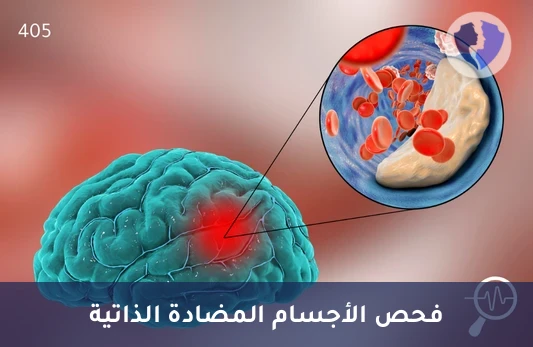 تحليل الأجسام المضادة للغانغليوزيدات (Gangliosides IgG) - فحص الأجسام المضادة للأعصاب