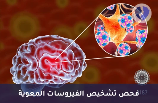 تحليل الأجسام المضادة للفيروسات المعوية (Enterovirus IgG & IgM) - فحص الفيروسات المعوية