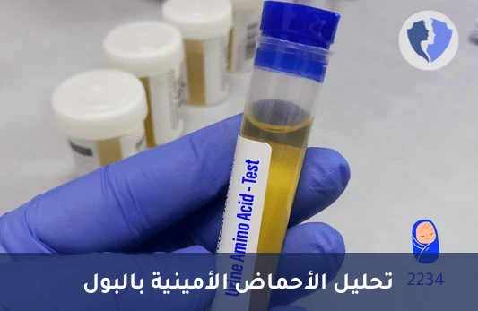 تحليل الأحماض الأمينية في البول - كمي (Amino Acids) - تحليل الأحماض الأمينية بالبول