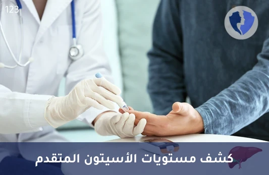 تحليل الأسيتون (Acetone) - فحص مستوى الأسيتون المتقدم