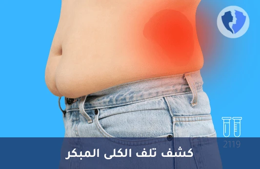 تحليل الزلال الدقيق في البول خلال 24 ساعة (Microalbumin) - فحص زلال البول (24 ساعة)