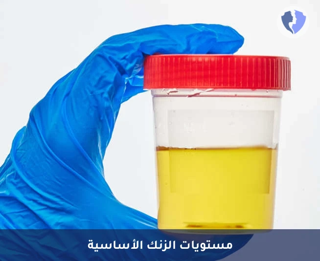 تحليل الزنك في البول خلال 24 ساعة (Zinc Urine) - قياس زنك البول