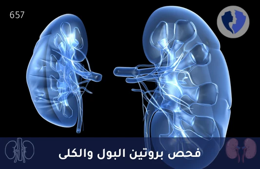 تحليل الفصل الكهربائي لبروتينات البول (Protein Electrophoresis) - فحص بروتينات البول والكلى