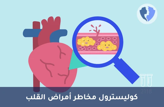 تحليل الكوليسترول الضار (LDL) - فحص الكوليسترول الضار (LDL)