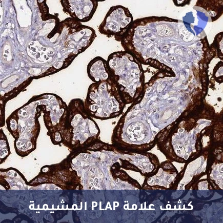 تحليل الكيمياء النسيجية المناعية لإنزيم الفوسفاتاز القلوي المشيمي (PLAP) - فحص أورام الخلايا الجرثومية
