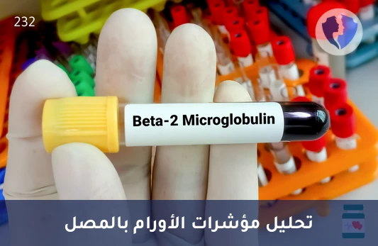 تحليل بيتا 2 ميكروغلوبولين في المصل (Beta-2-Microglobulin) - تحليل بيتا-2 ميكروجلوبولين