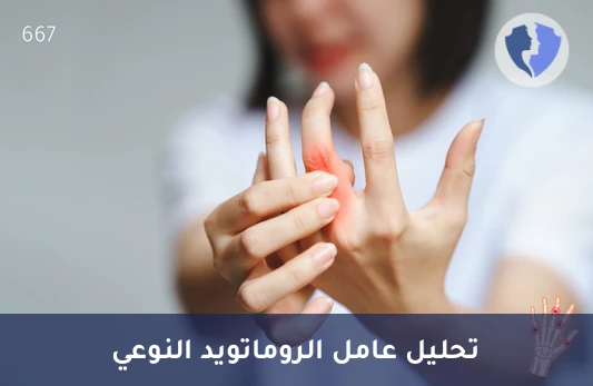 تحليل عامل الروماتويد - النوع (IgA) - فحص عامل الروماتويد IgA
