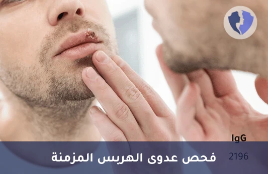 تحليل فيروس الهربس البسيط النوع الثاني (HSV-2 IgG) - فحص فيروس الهربس النوع الثاني (IgG)
