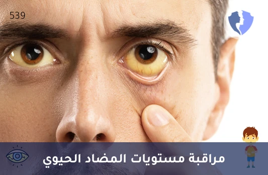 تحليل مستوى الدوكسيسيكلين (Doxycycline) - تابع فعالية علاج الدوكسيسيكلين