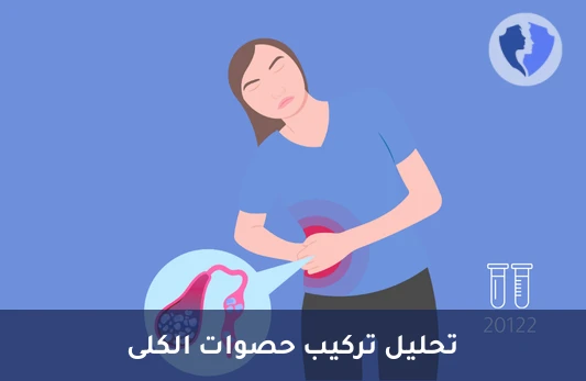 تحليل مكونات الحصى (Stone Analysis) - تحليل حصوات الكلى للوقاية