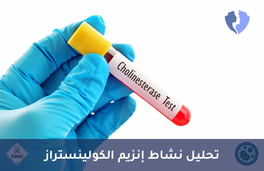 تحليل نشاط إنزيم الكولينستراز (Cholinesterase by HPLC) - نشاط إنزيم الكولينستريز