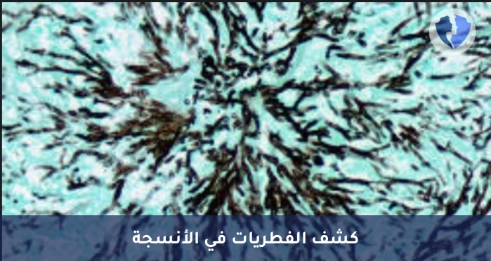 صبغة الفضة النسيجية (GMS) - صبغة الفضة للكشف عن الفطريات