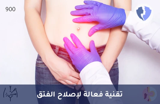 عملية إصلاح الفتق مع تركيب شبكة جراحية - إصلاح الفتق بالشبكة الجراحية