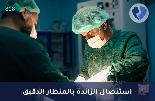 عملية استئصال الزائدة الدودية بالمنظار - استئصال الزائدة الدودية بالمنظار