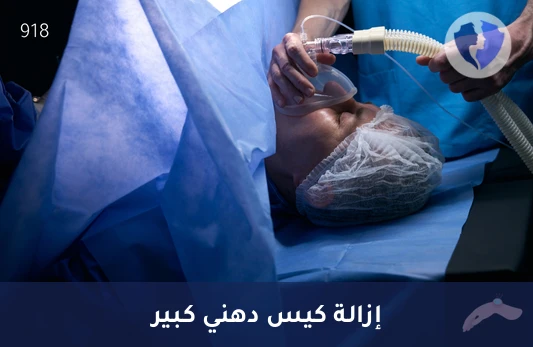 عملية استئصال كيس دهني كبير تحت التخدير الموضعي - إزالة كيس دهني كبير