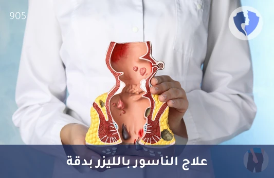 عملية علاج الناسور الشرجي المنخفض بالليزر - علاج الناصور بالليزر