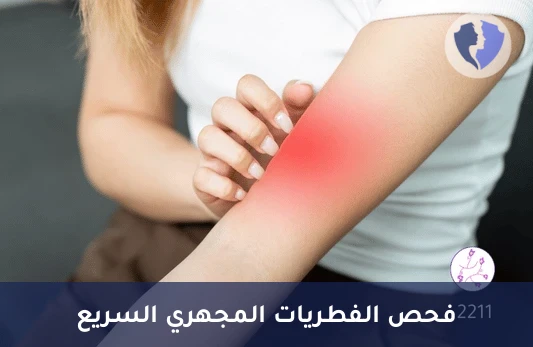 فحص الفطريات المجهري (KOH) - فحص الفطريات السريع (KOH)