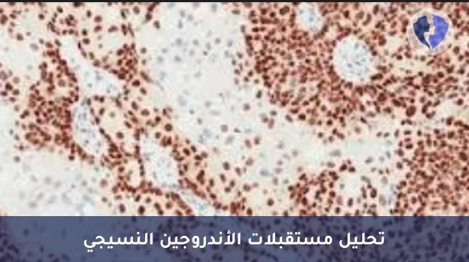 فحص الكيمياء النسيجية المناعية لمستقبلات الأندروجين (AR) - فحص مستقبلات الأندروجين (AR)