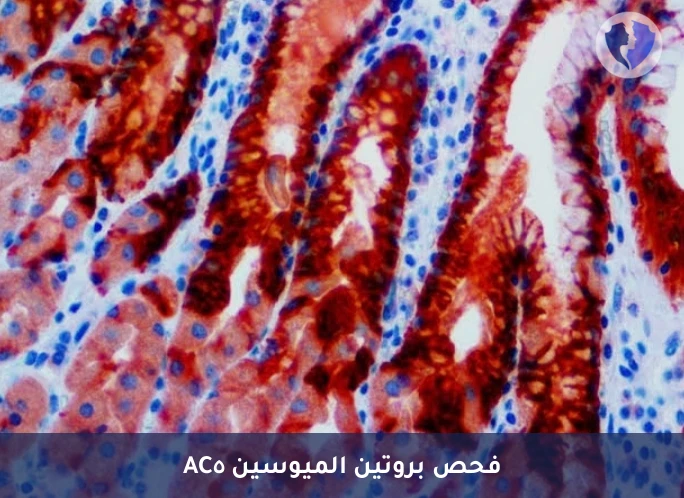فحص بروتين الميوسين 5AC الكيميائي النسيجي المناعي (MUC5AC) - فحص أورام المعدة والبنكرياس