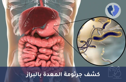 فحص جرثومة المعدة في البراز (H. pylori Antigen) - فحص جرثومة المعدة بالبراز