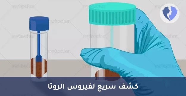 فحص فيروس الروتا في البراز (Rotavirus Antigen) - كشف فيروس الروتا