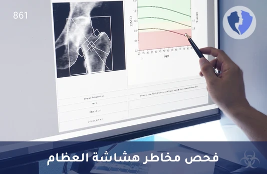 فحص قياس كثافة العظام (DEXA) - فحص قياس كثافة العظام