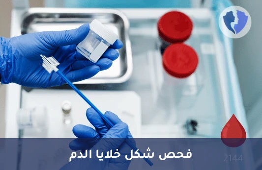 فحص لطخة الدم الطرفية (Peripheral Blood Film) - فحص لطاخة الدم