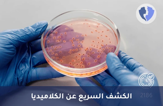 فحص مستضد الكلاميديا (Chlamydia Antigen) - كشف مستضد الكلاميديا المباشر