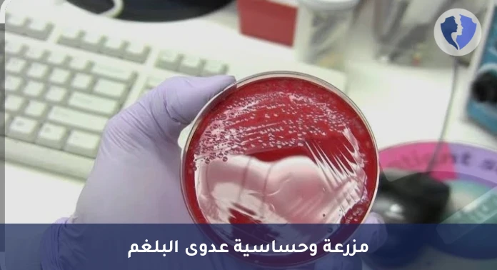مزرعة وحساسية البلغم - مزرعة بلغم لتشخيص الصدر