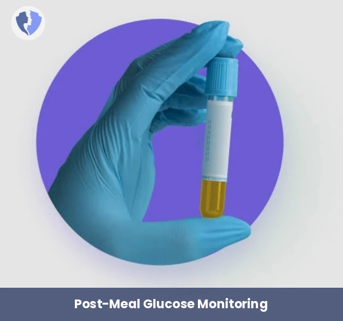 2-Hour Postprandial Glucose Test