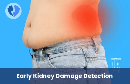 24-Hour Urine Microalbumin Test